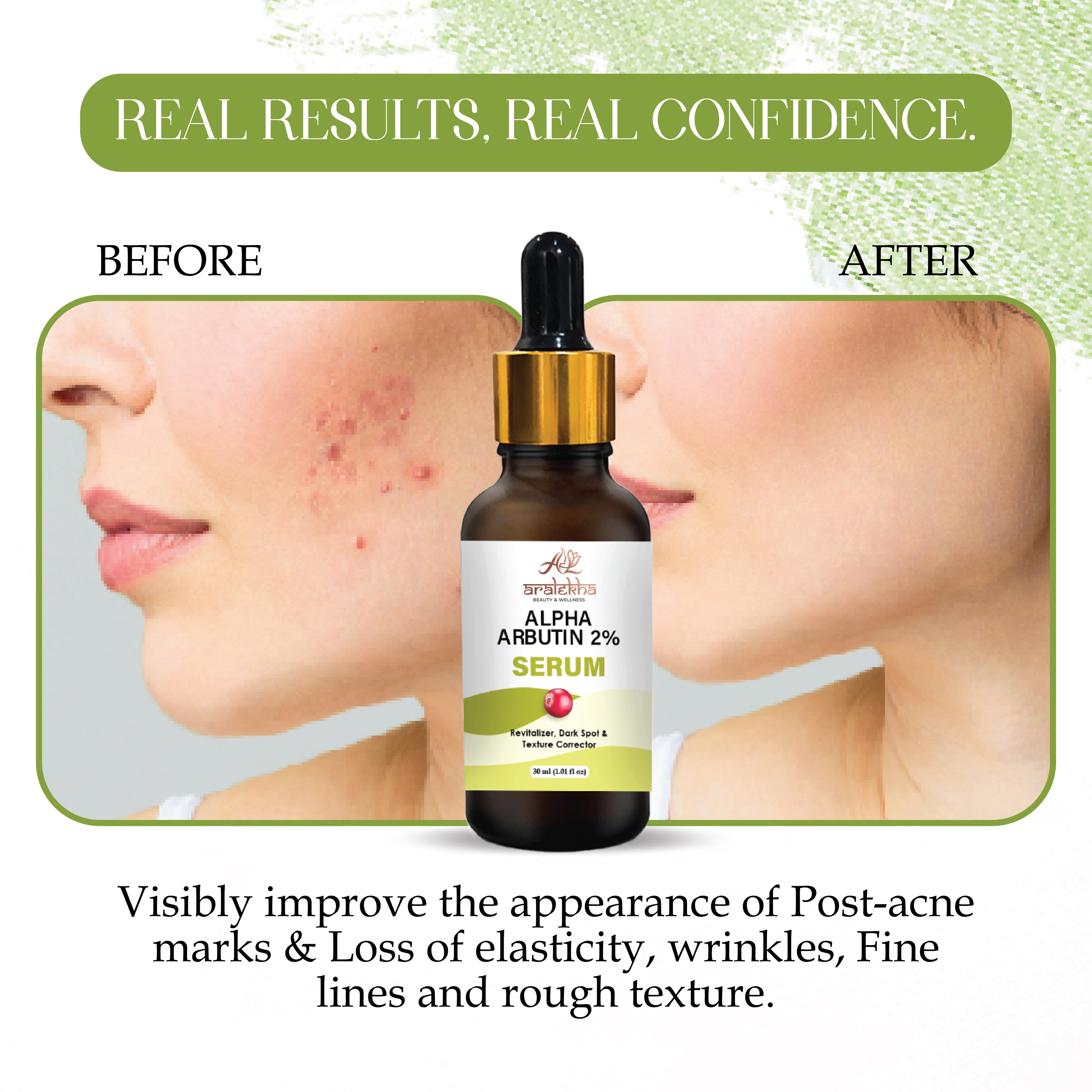 Aralekha Alpha Arbutin 2% Face Serum for Dark Spots, Uneven Skin Tone & Texture Care | Lightweight Brightening Facial Serum for Men & Women 30ml