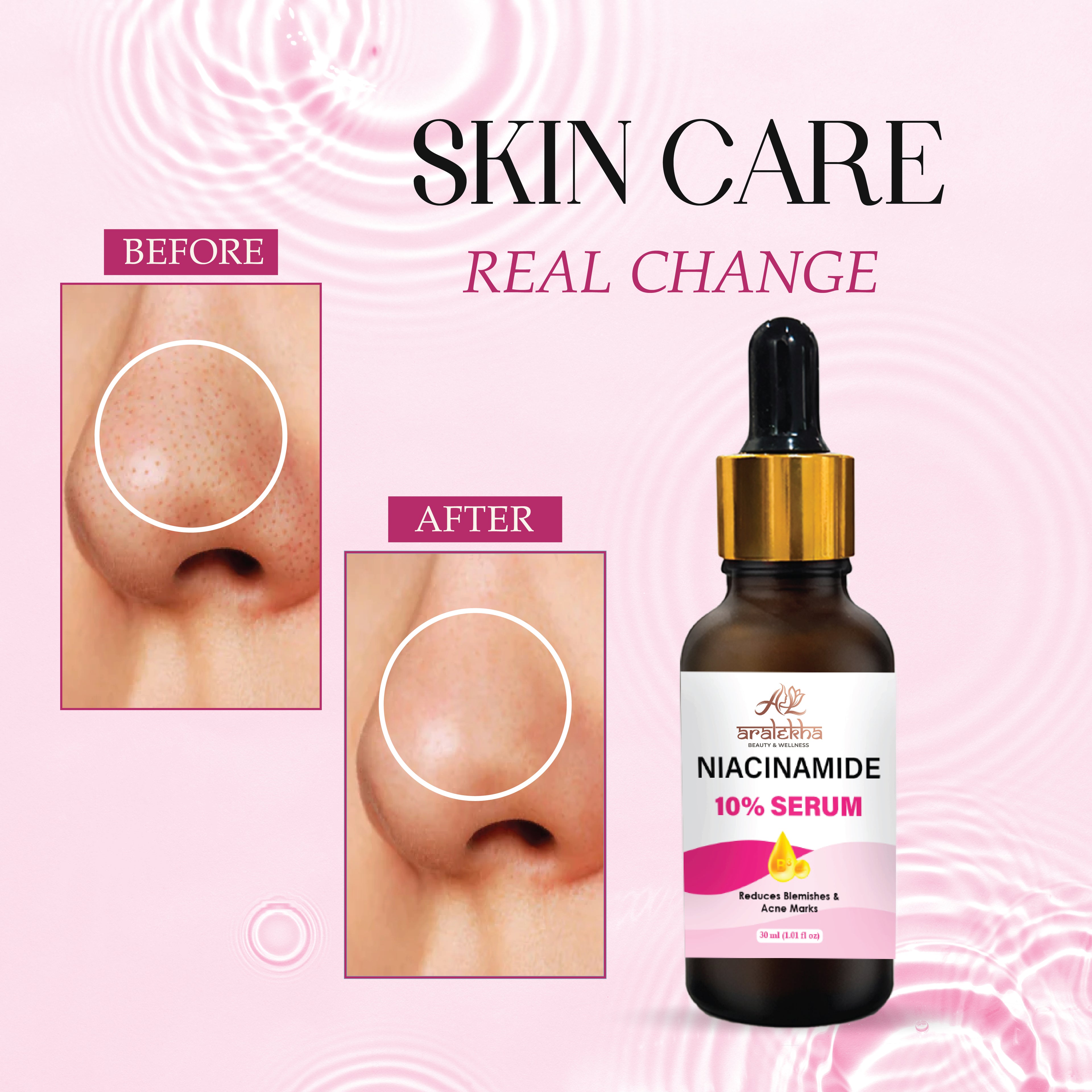 Aralekha Niacinamide 10% Face Serum for Blemishes, Acne Marks & Smooth Skin Texture | Lightweight Facial Serum for Oily & Acne-Prone Skin 30ml