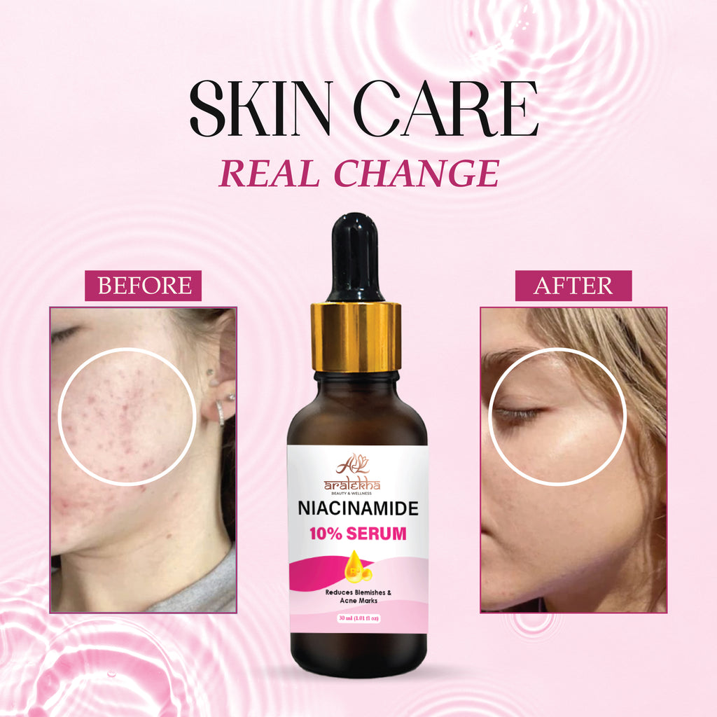 Aralekha Niacinamide 10% Face Serum for Blemishes, Acne Marks & Smooth Skin Texture | Lightweight Facial Serum for Oily & Acne-Prone Skin 30ml