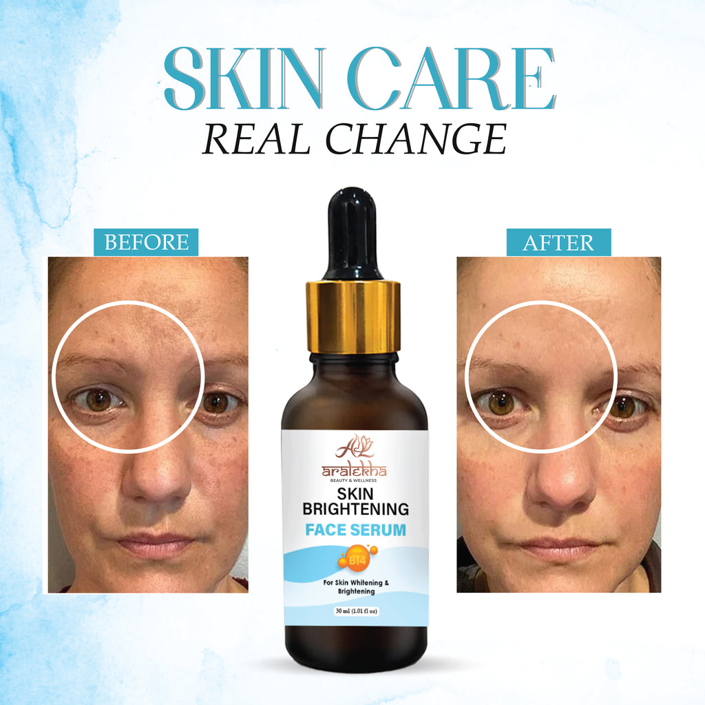 Aralekha Skin Brightening Face Serum with Vitamin B14 for Dull & Uneven Looking Skin | Lightweight Hydrating Facial Serum for Men & Women 30ml