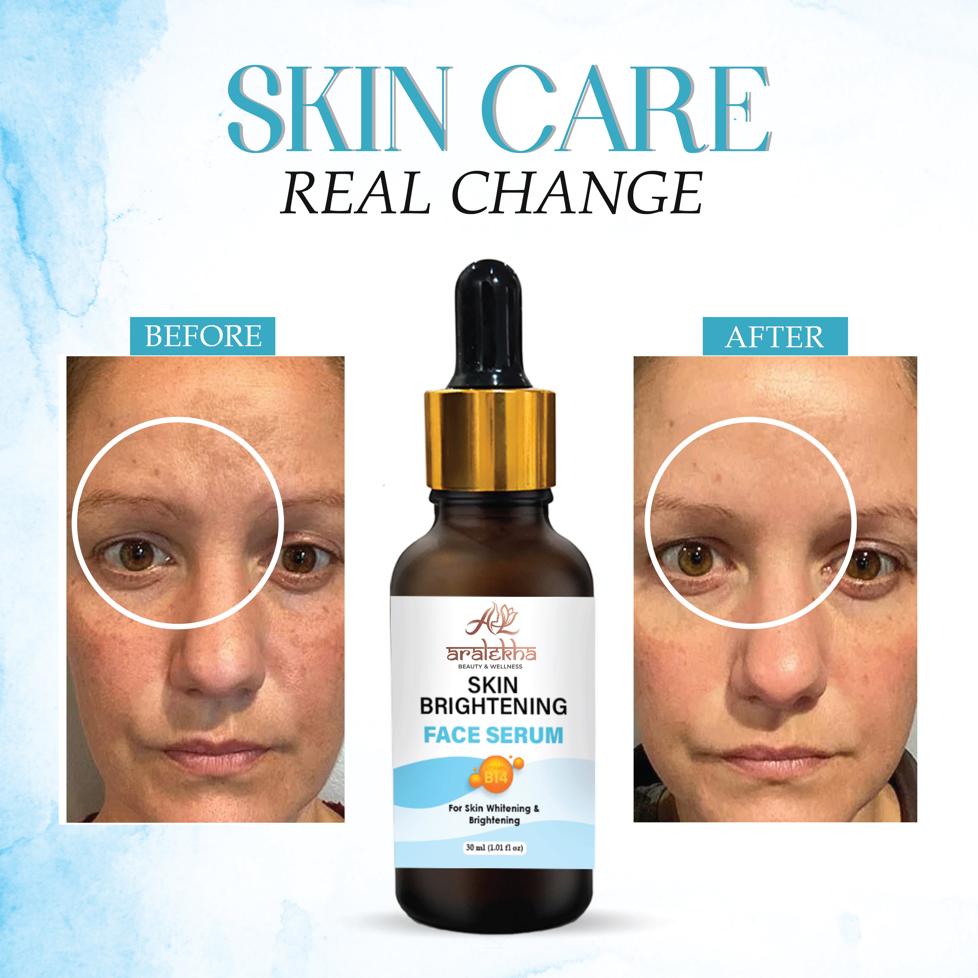 Aralekha Skin Brightening Face Serum with Vitamin B14 for Dull & Uneven Looking Skin | Lightweight Hydrating Facial Serum for Men & Women 30ml