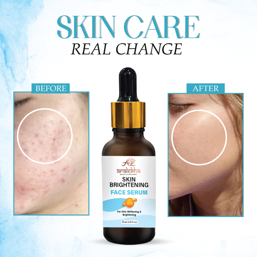 Aralekha Skin Brightening Face Serum with Vitamin B14 for Dull & Uneven Looking Skin | Lightweight Hydrating Facial Serum for Men & Women 30ml
