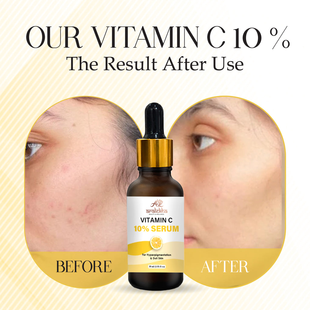 Aralekha Vitamin C 10% Face Serum for Dull Looking Skin & Uneven Skin Tone | Lightweight Brightening Facial Serum for Men & Women 30ml