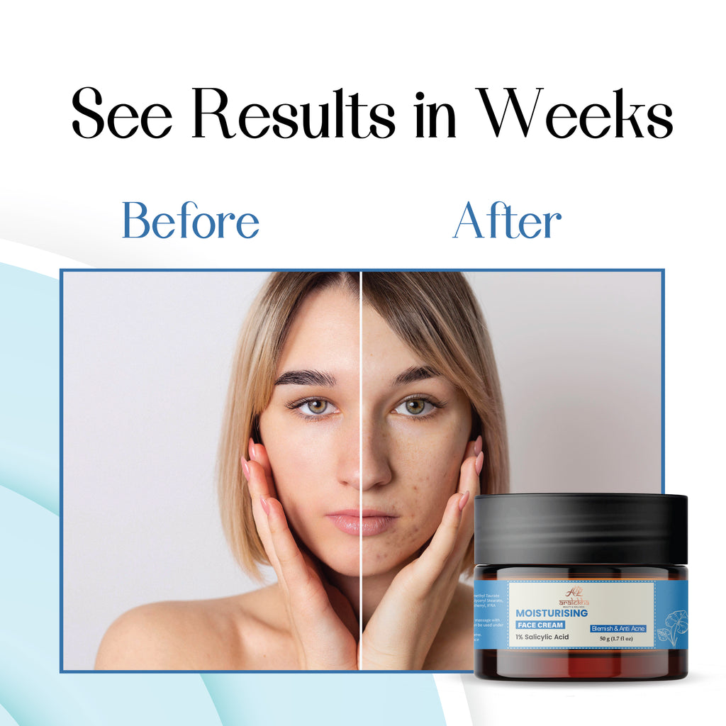 Aralekha Moisturising Face Cream with 1% Salicylic Acid for Blemish & Acne Care | Lightweight Non-Greasy Daily Face Moisturizer for Men & Women 50g